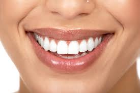 Snowhite Teeth Whitening - tanden bleken - kopen - fabricant - forum