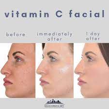 Tonik Vitamin C Skin Refiner - wat is - gebruiksaanwijzing - recensies - bijwerkingen
